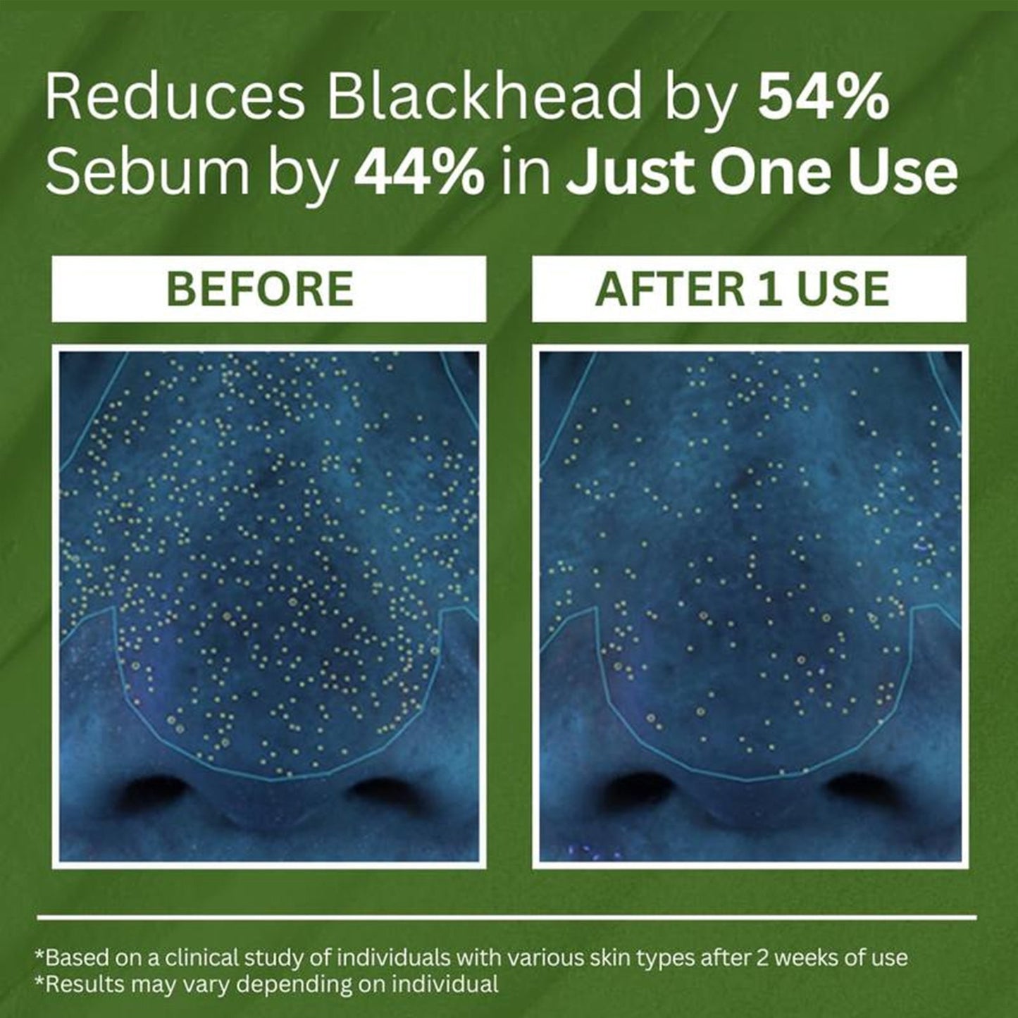 Holy Basil Bubble Deep Facial Mask